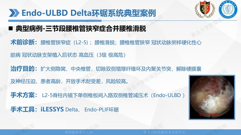 1. ULBD技术体系构建及临床应用 2023.4.5 - 15min_39.jpg