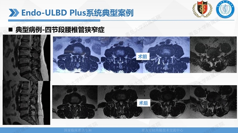 1. ULBD技术体系构建及临床应用 2023.4.5 - 15min_48.jpg