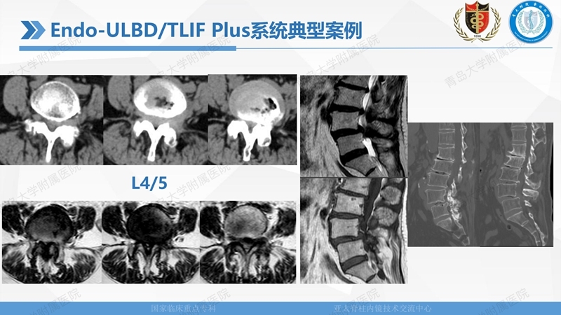 1. ULBD技术体系构建及临床应用 2023.4.5 - 15min_50.jpg