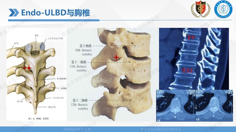1. ULBD技术体系构建及临床应用 2023.4.5 - 15min_58.jpg