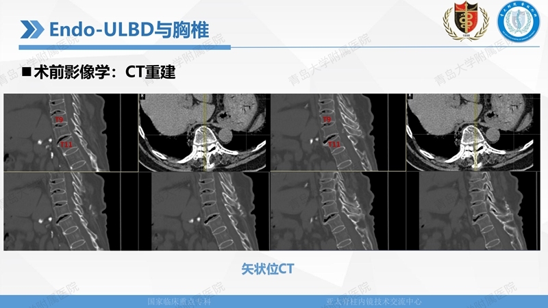 1. ULBD技术体系构建及临床应用 2023.4.5 - 15min_63.jpg
