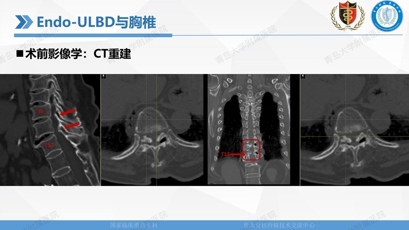 1. ULBD技术体系构建及临床应用 2023.4.5 - 15min_64.jpg