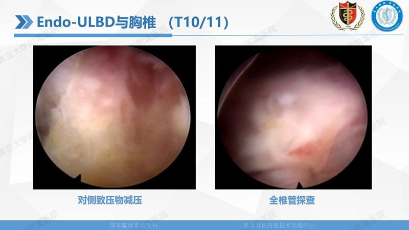 1. ULBD技术体系构建及临床应用 2023.4.5 - 15min_70.jpg
