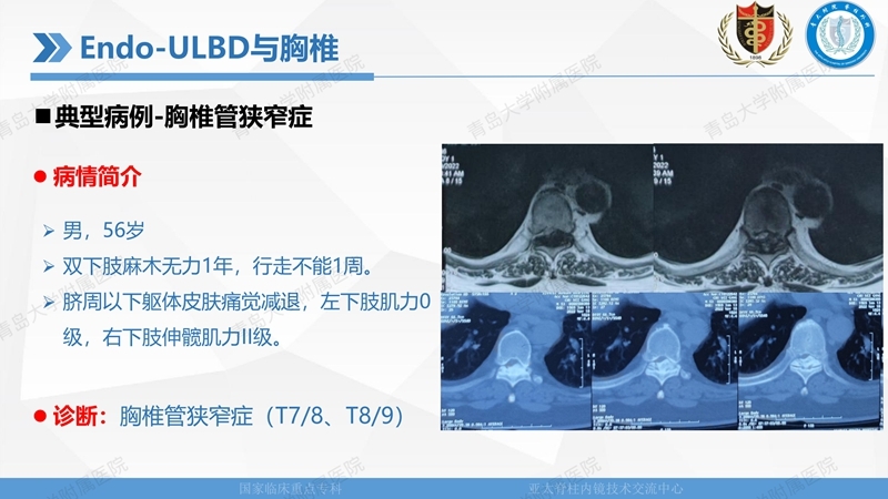 1. ULBD技术体系构建及临床应用 2023.4.5 - 15min_81.jpg