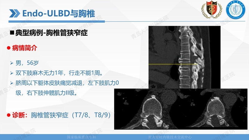 1. ULBD技术体系构建及临床应用 2023.4.5 - 15min_84.jpg