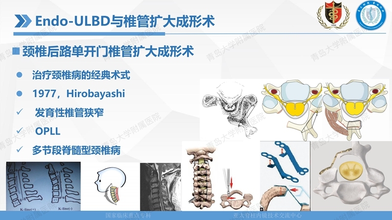 1. ULBD技术体系构建及临床应用 2023.4.5 - 15min_90.jpg