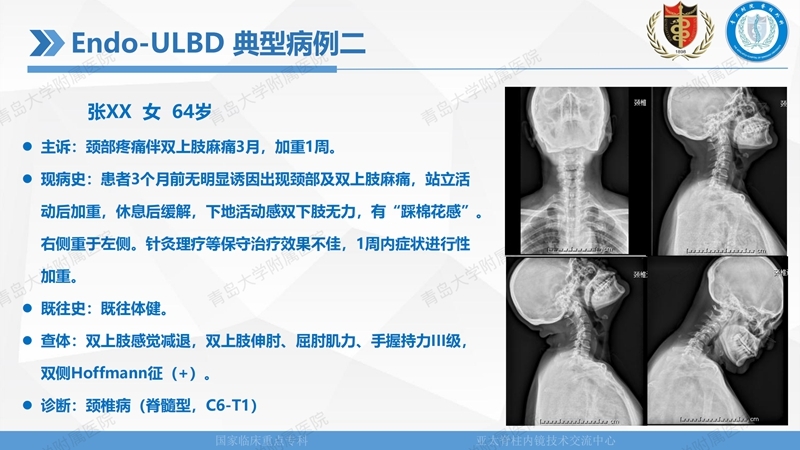1. ULBD技术体系构建及临床应用 2023.4.5 - 15min_97.jpg