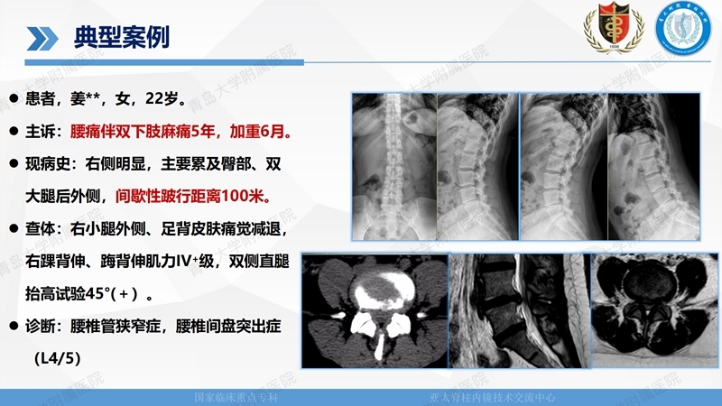 1. ULBD技术体系构建及临床应用 2023.4.5 - 15min_108.jpg