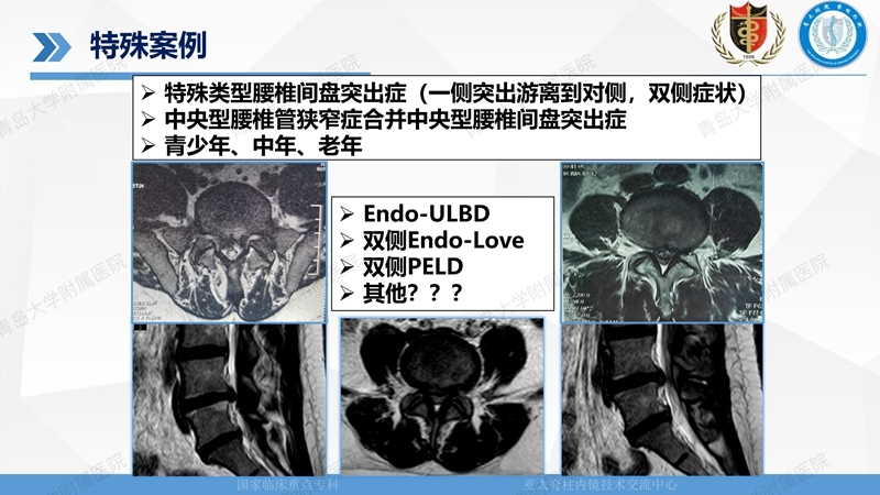 1. ULBD技术体系构建及临床应用 2023.4.5 - 15min_107.jpg