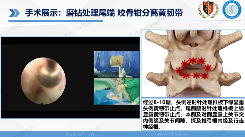 1. ULBD技术体系构建及临床应用 2023.4.5 - 15min_111.jpg