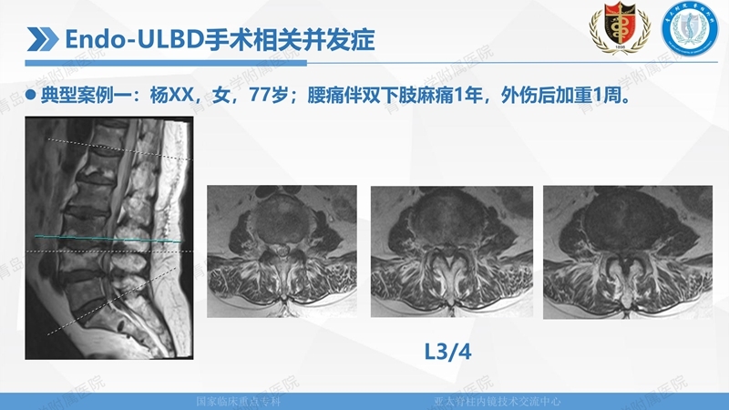 1. ULBD技术体系构建及临床应用 2023.4.5 - 15min_125.jpg