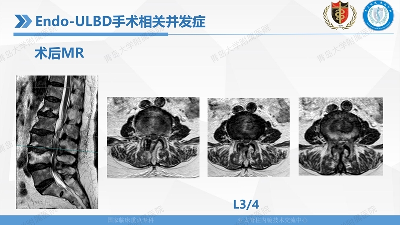 1. ULBD技术体系构建及临床应用 2023.4.5 - 15min_133.jpg