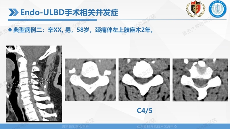 1. ULBD技术体系构建及临床应用 2023.4.5 - 15min_137.jpg