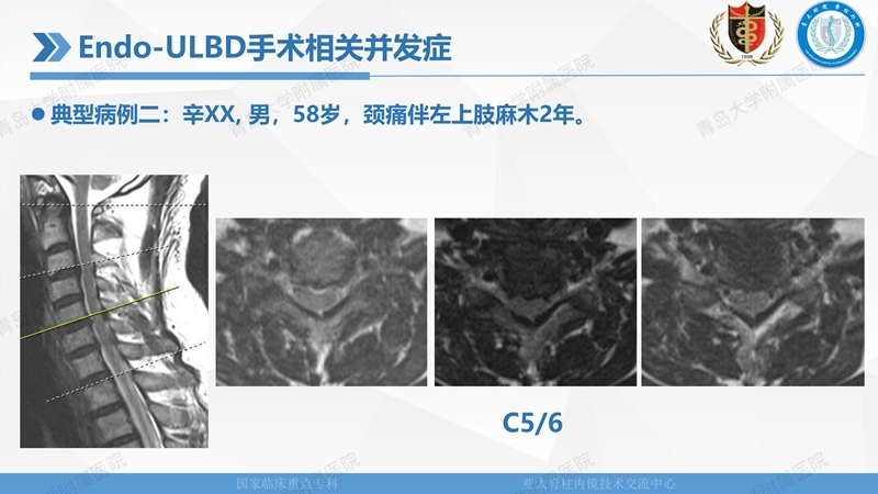1. ULBD技术体系构建及临床应用 2023.4.5 - 15min_140.jpg