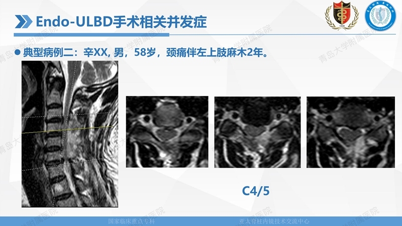 1. ULBD技术体系构建及临床应用 2023.4.5 - 15min_144.jpg