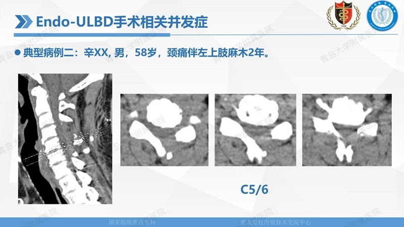 1. ULBD技术体系构建及临床应用 2023.4.5 - 15min_143.jpg
